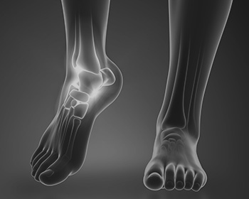 Foot & Ankle